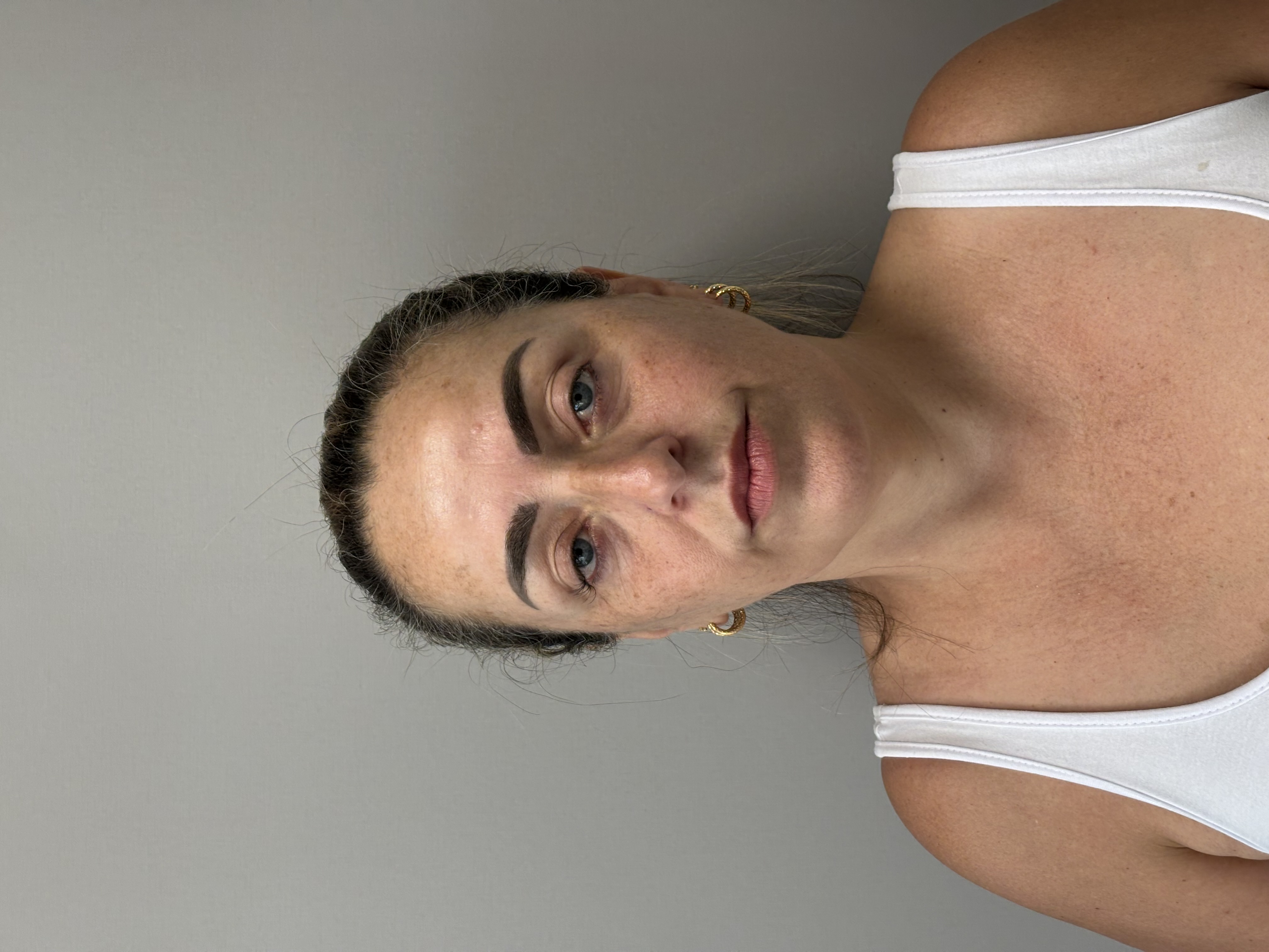 Resultado após procedimento