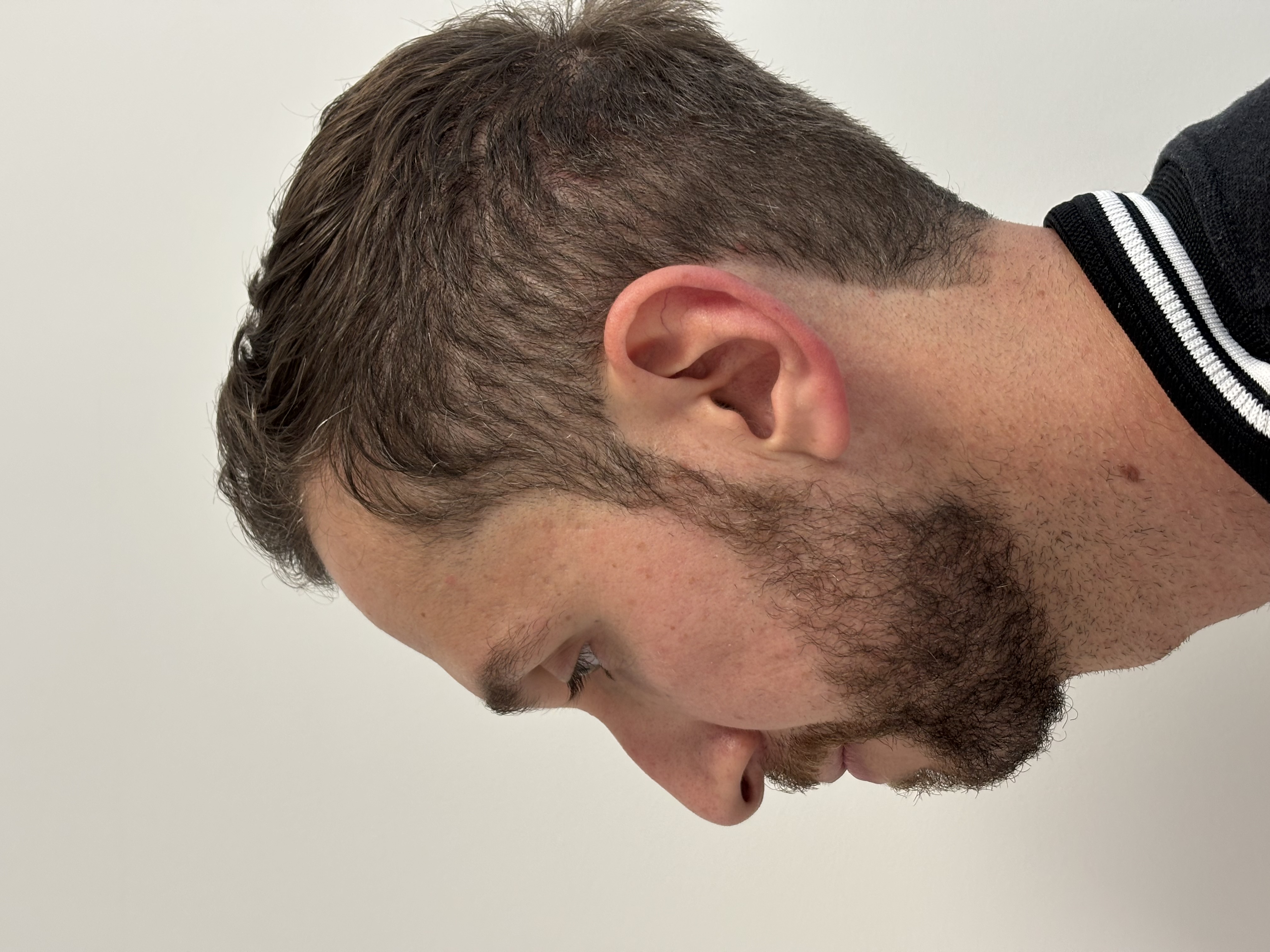 Antes do procedimento