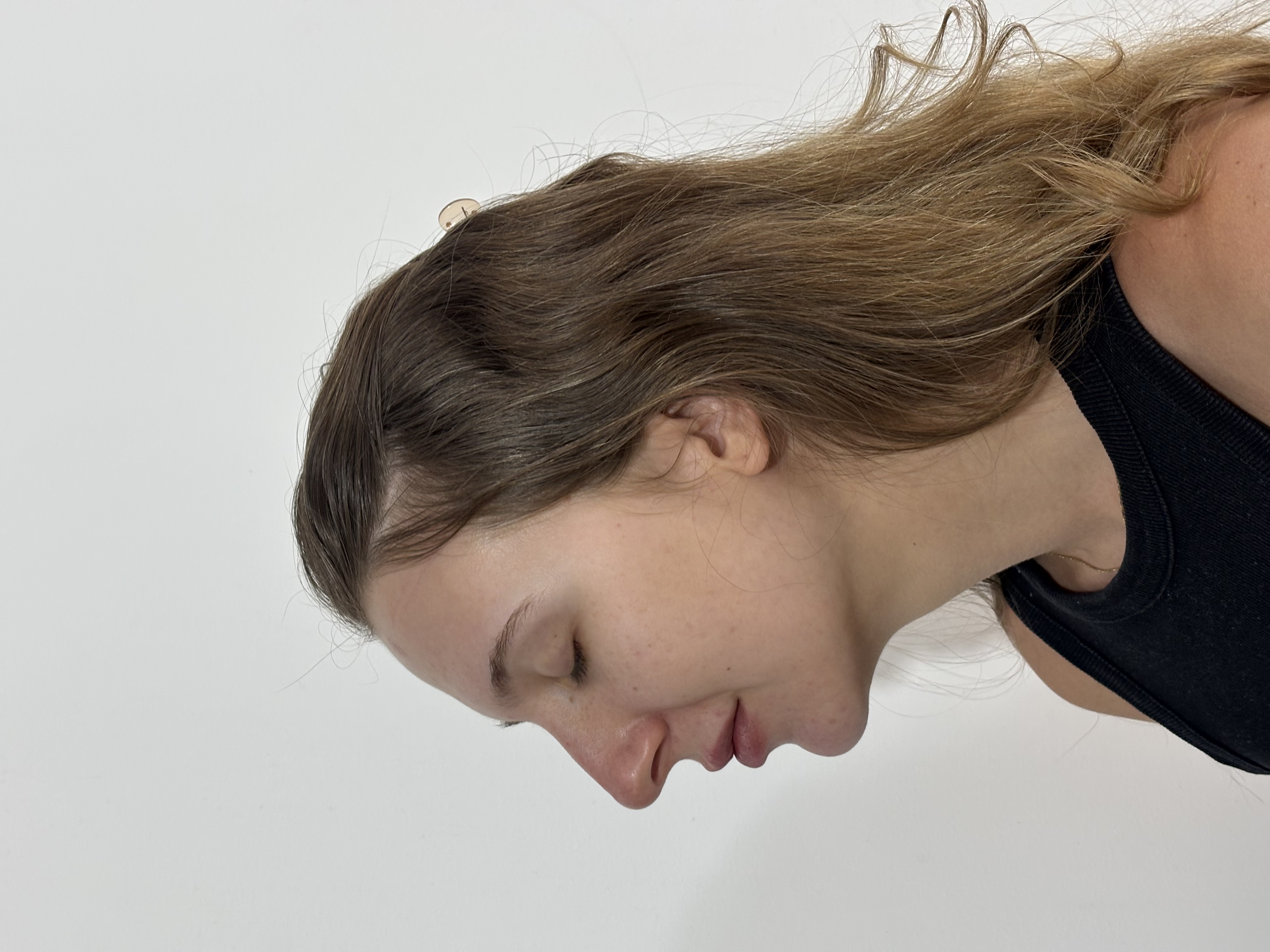 Resultado após procedimento