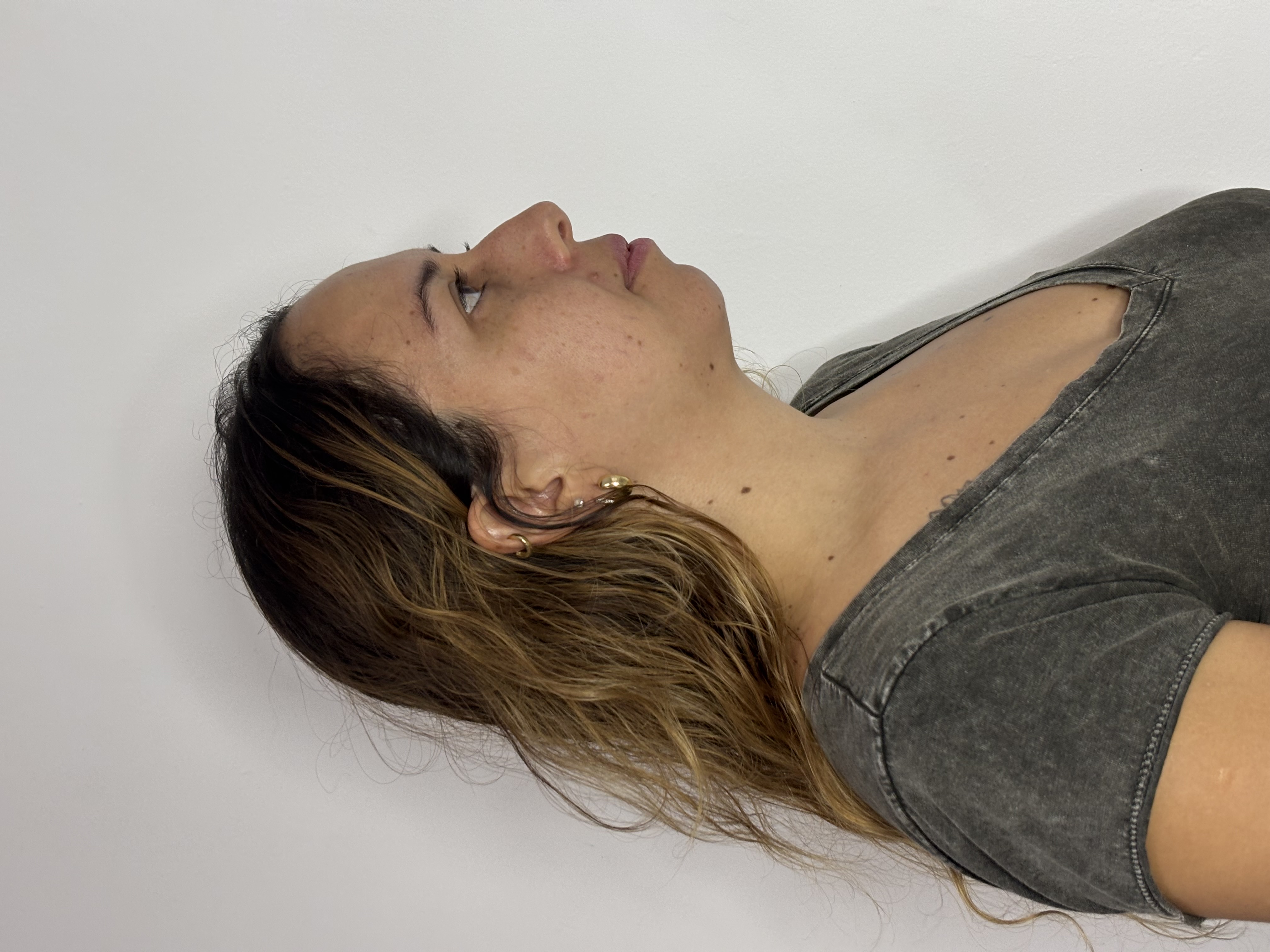 Antes do procedimento