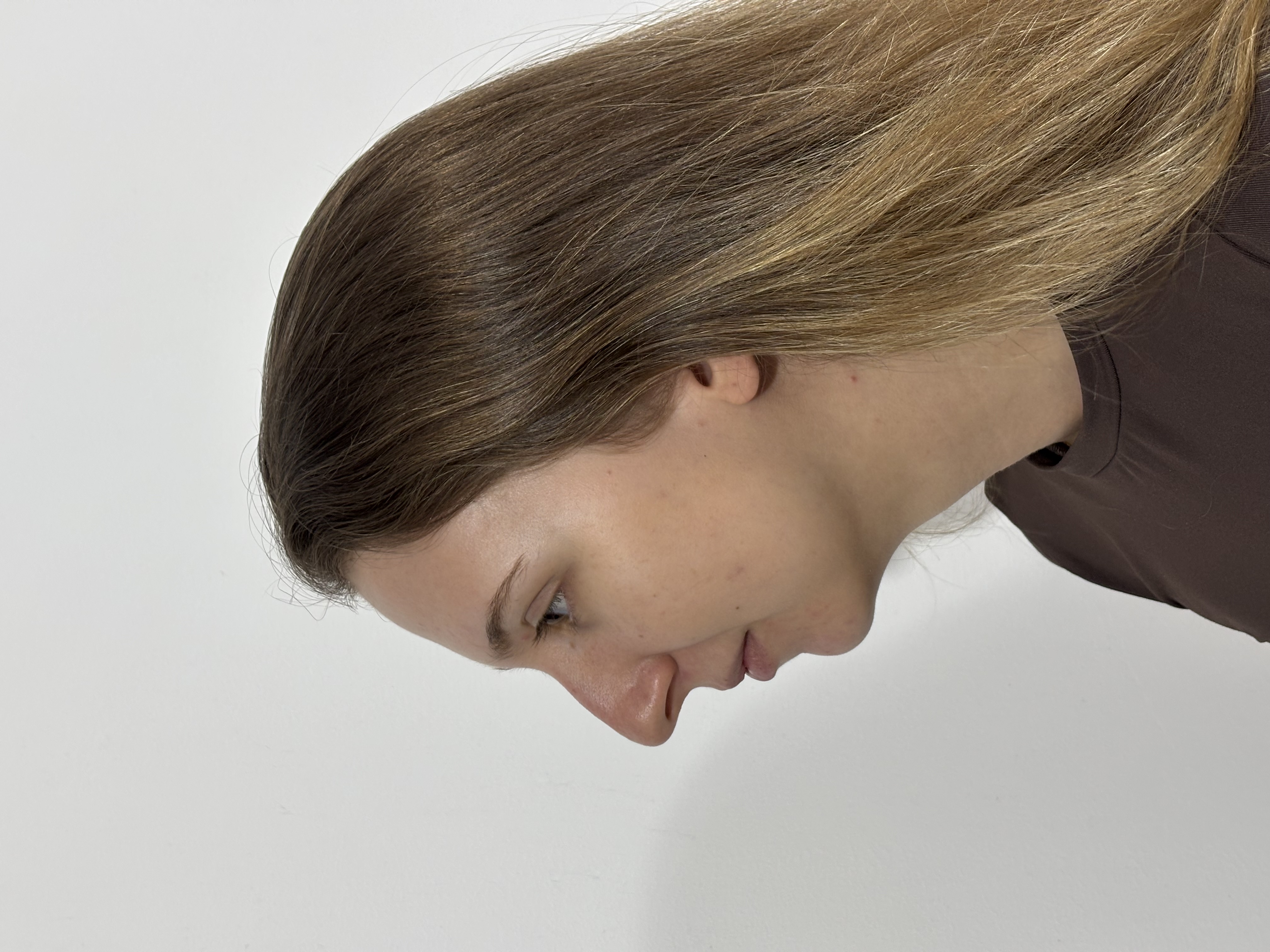 Antes do procedimento