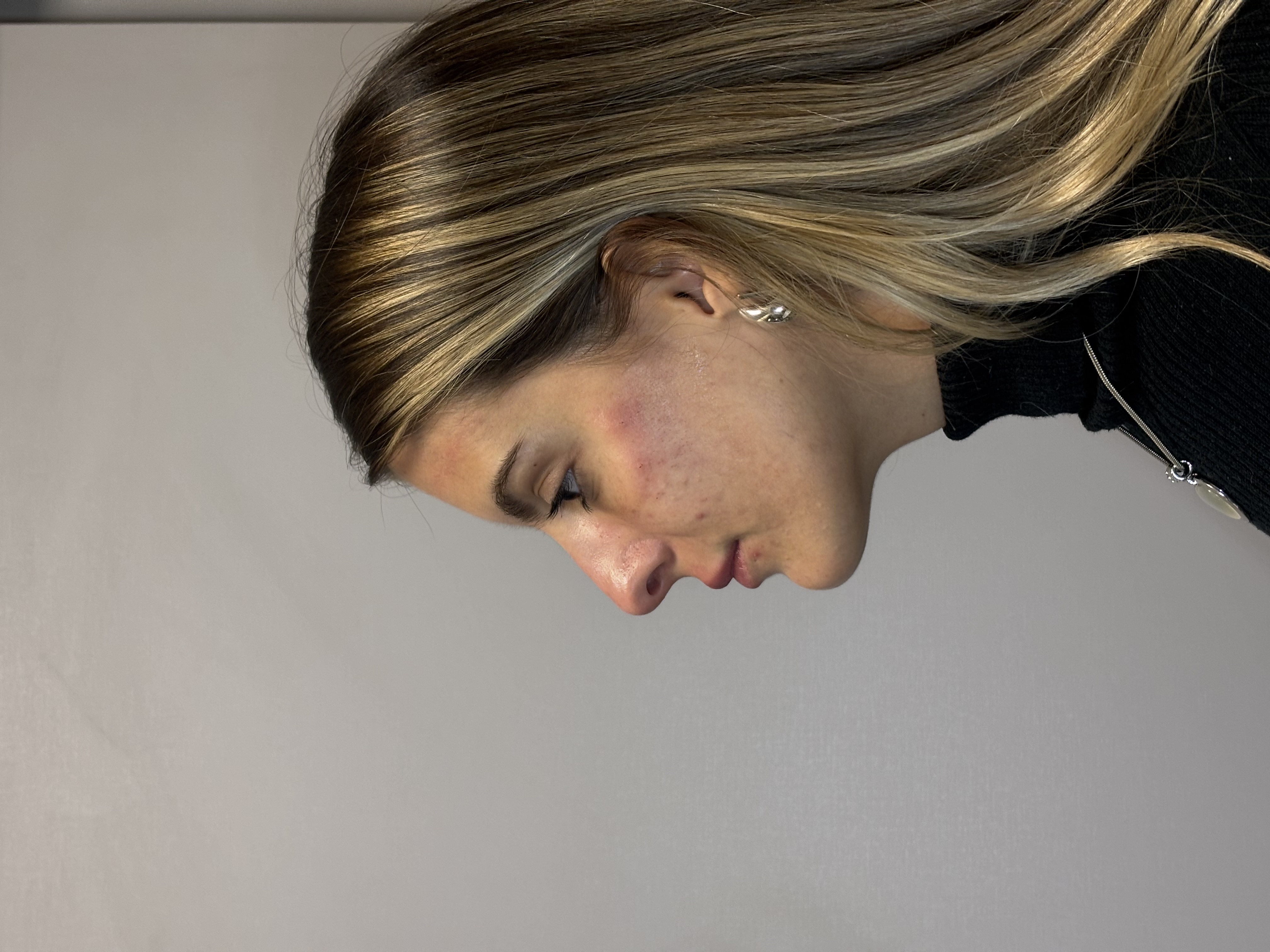 Resultado após procedimento