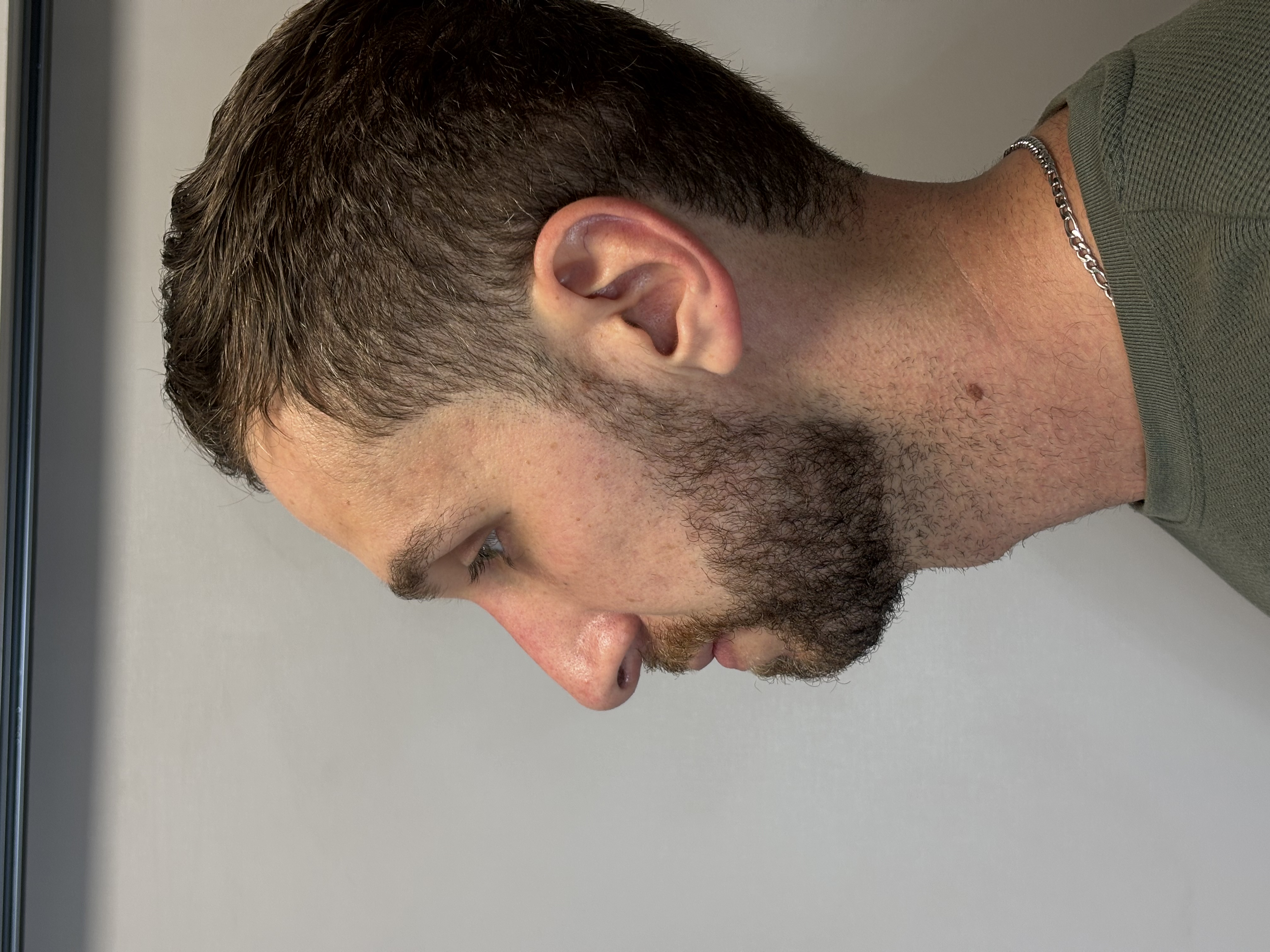 Resultado após procedimento