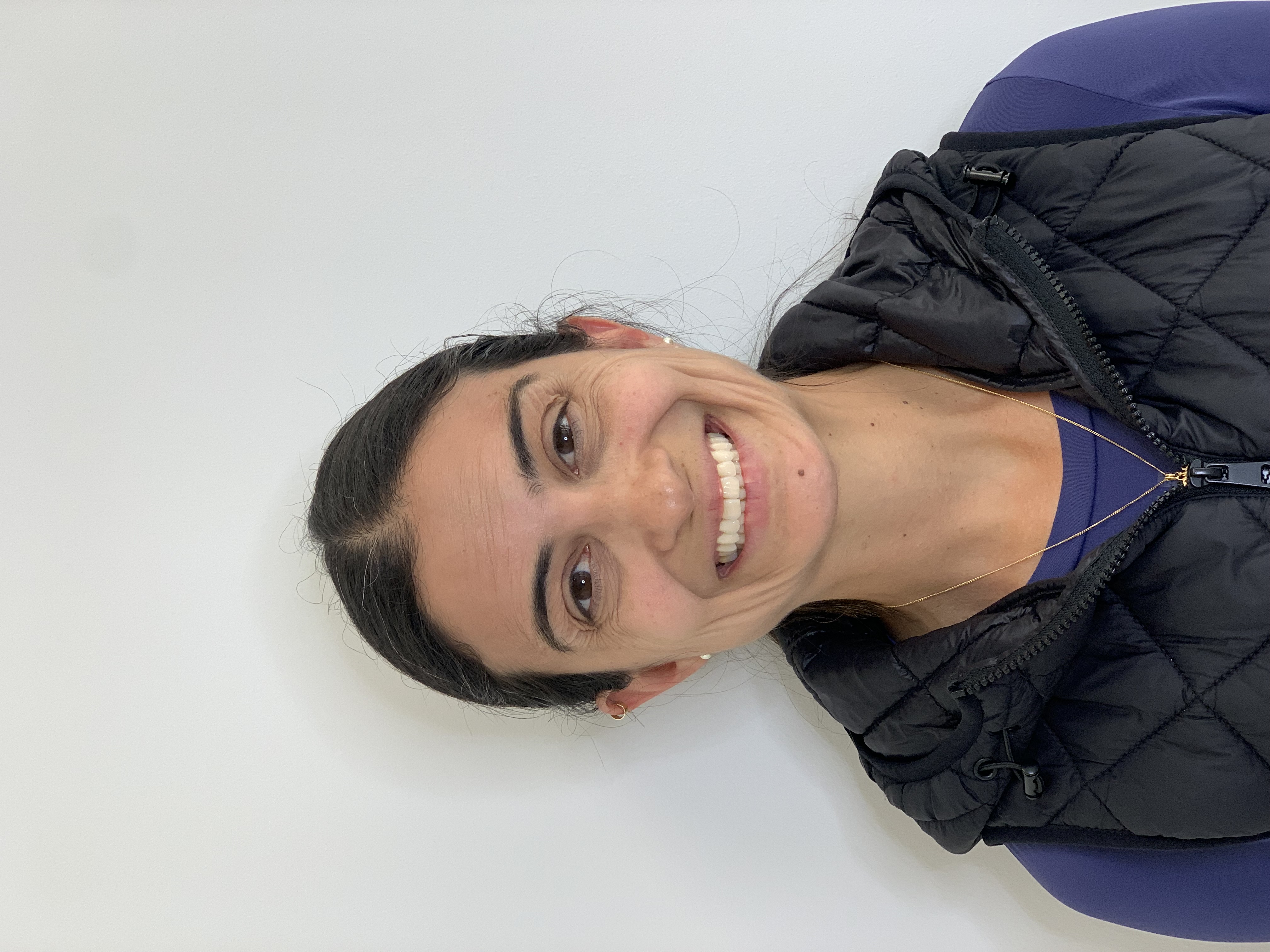 Antes do procedimento